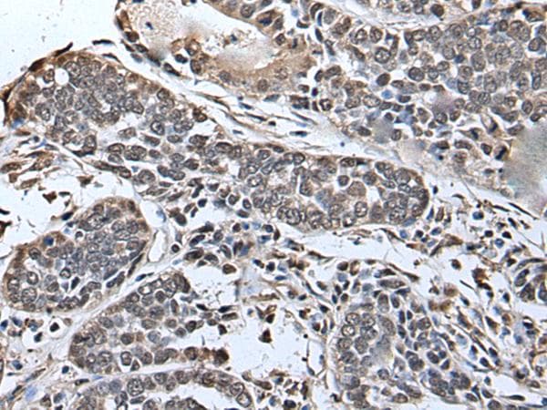 Polyclonal Rabbit anti-Human SLITRK5 Antibody (IHC)