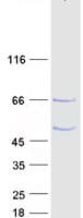 Human C1orf94 Protein (Recombinant Myc-DDK (Flag))