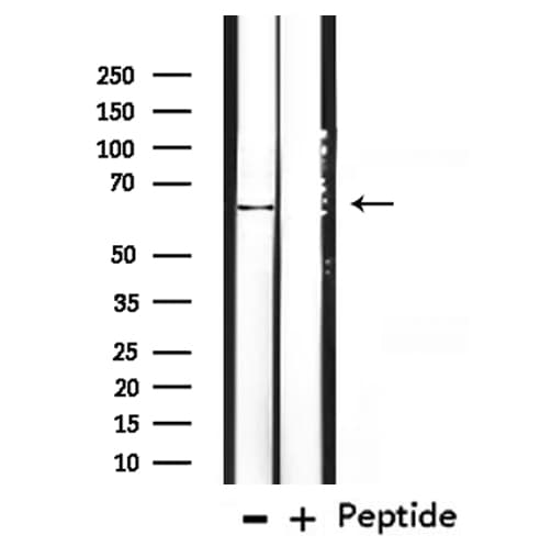 Polyclonal Rabbit anti-Human KRT3 / CK3 / Cytokeratin 3 Antibody (IHC, WB)