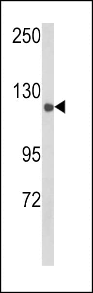 Polyclonal Rabbit anti-Human CLASP2 Antibody (Tyr1019, WB)