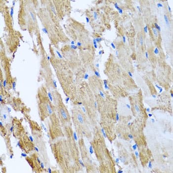CCM2 / Malcavernin Antibody