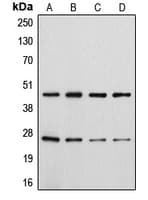 CD28 Antibody (phospho-Tyr218)
