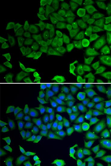 VPS4A Antibody