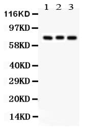 PRKCB / PKC-Beta Antibody (aa542-671)