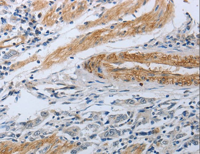 Polyclonal Rabbit anti-Human NPRA / NPR1 Antibody (IHC)