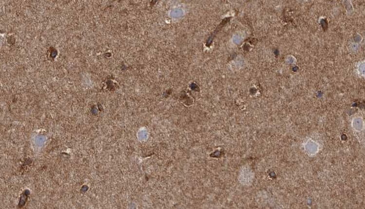 TRPM2 Antibody