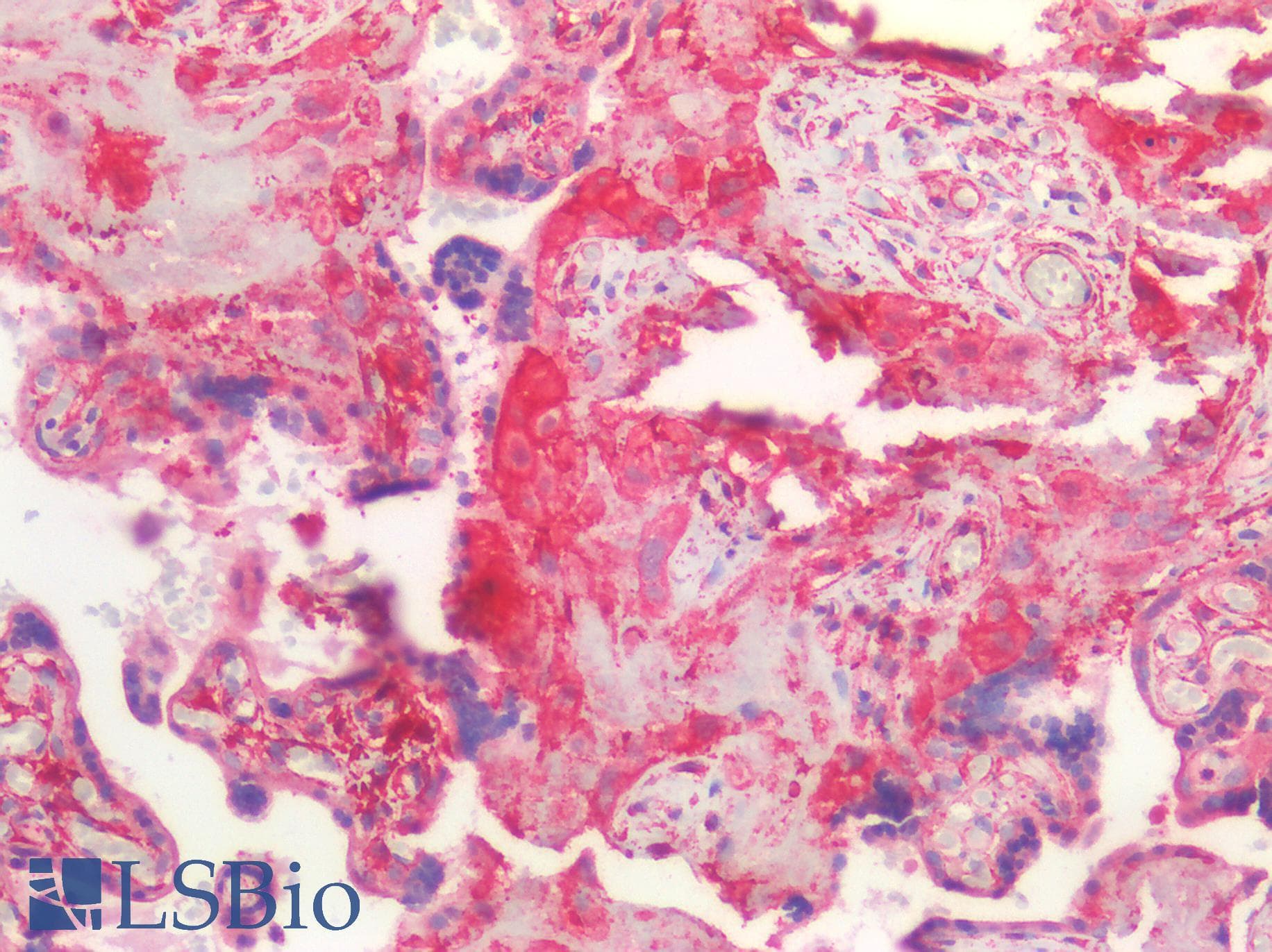 IHC-plus™ Polyclonal Rabbit anti-Human OCLN / Occludin Antibody (IHC)