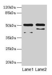 Polyclonal Rabbit anti-Human CRFR1 / CRHR1 Antibody (WB)