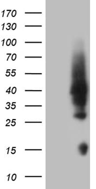 HOXD4 Antibody (clone OTI2E8)