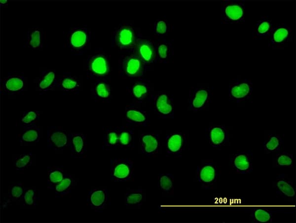 PBX2 Antibody (clone 2E9)