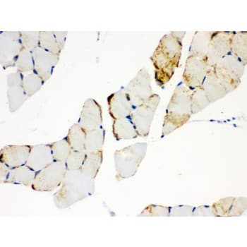 CPT1B Antibody (aa197-226)