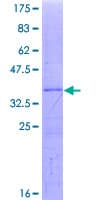 Human UBE3C Protein (Recombinant GST, N-terminus)