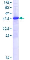 Human PSMD10 / Gankyrin Protein (Recombinant GST)