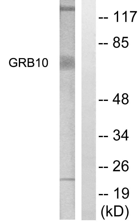 GRB10 Antibody (aa33-82)
