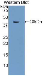 AQP1 / Aquaporin 1 Antibody (aa201-269)