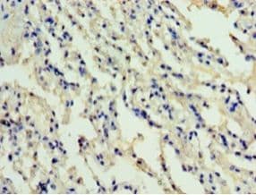 ADM / Adrenomedullin Antibody (aa45-92, Biotin)