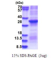 Human F2 / Prothrombin / Thrombin Protein (Recombinant)