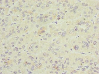 Polyclonal Rabbit anti-Human GDAP1 Antibody (IHC, WB)