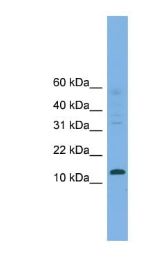 CRABP2 Antibody (aa35-84)