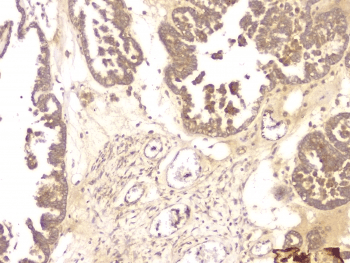 Polyclonal Rabbit anti-Human BMP15 Antibody (IHC, WB)