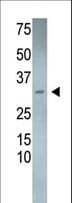 RCAN3 / Calcipressin 3 Antibody (aa19-51)