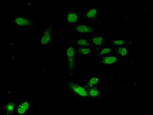 EMD / Emerin Antibody