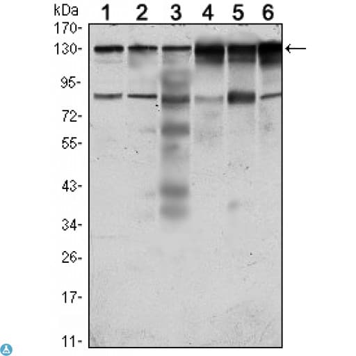 CCK4 / PTK7 Antibody