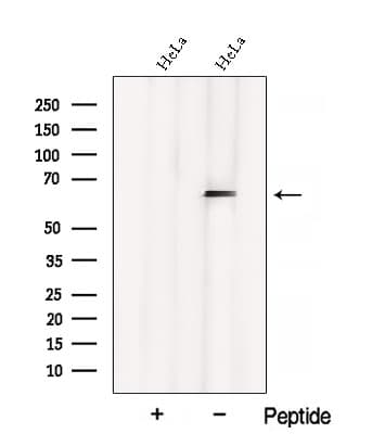 Polyclonal Rabbit anti-Human CSRNP1 / AXUD1 Antibody (WB)