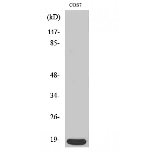 Polyclonal Rabbit anti-Human CDKN2C / p18 INK4c Antibody (80-160 aa, C-terminal, IHC, WB)