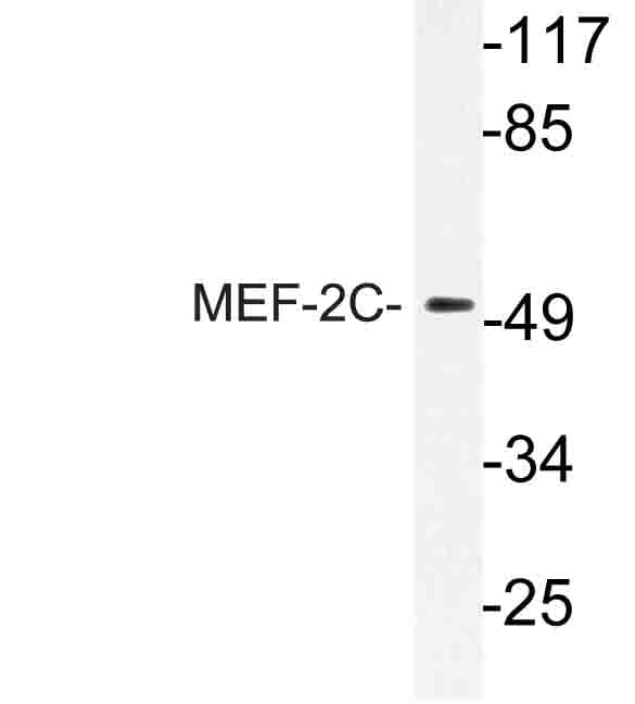 MEF2C Antibody (Ile390)