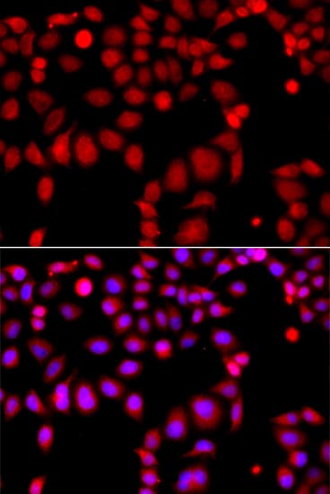 ARHGEF9 / Collybistin Antibody