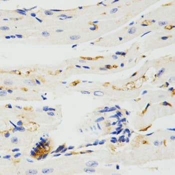Polyclonal Rabbit anti-Human TRAF7 Antibody (IHC, WB)