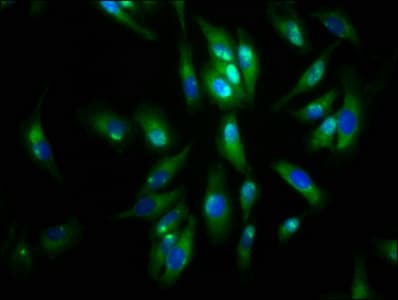 AGRN / Agrin Antibody