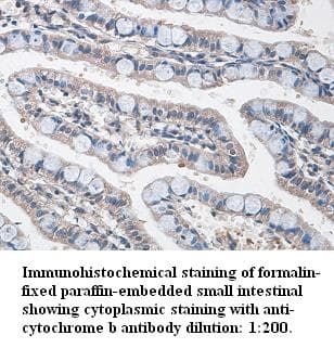 Yeast Serine / Threonine Protein Kinase YPK2 / YKR2 Antibody (C-Terminus)