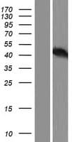 Human TP53 / p53 Protein (Over-Expression Lysate Myc-DDK (Flag))