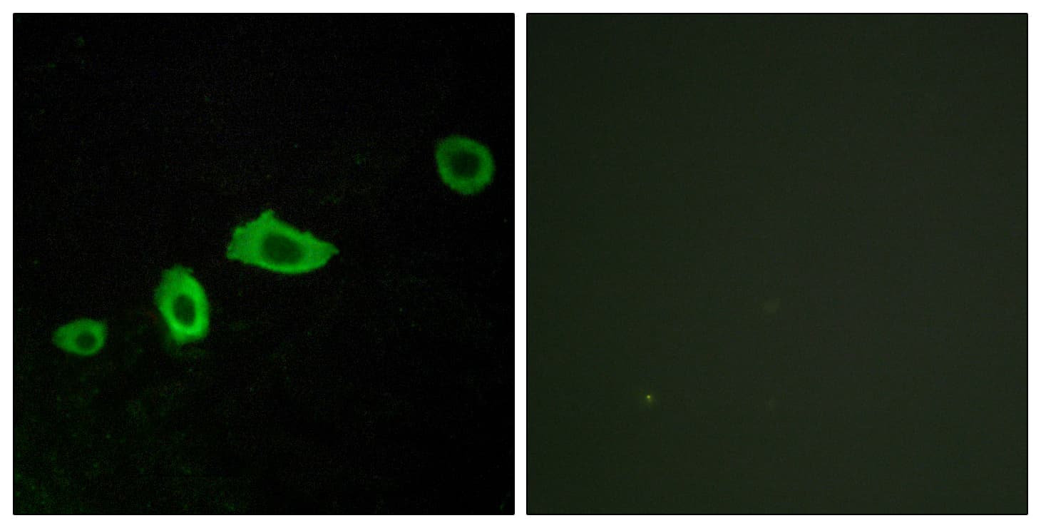 HTR5A / 5-HT5A Receptor Antibody (aa15-64)