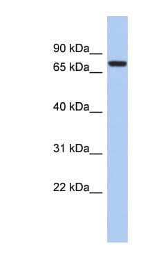 SNRK Antibody (aa539-588)