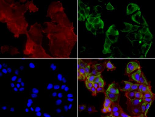 KRT19 / CK19 / Cytokeratin 19 Antibody (aa240-390, clone UMAB2)