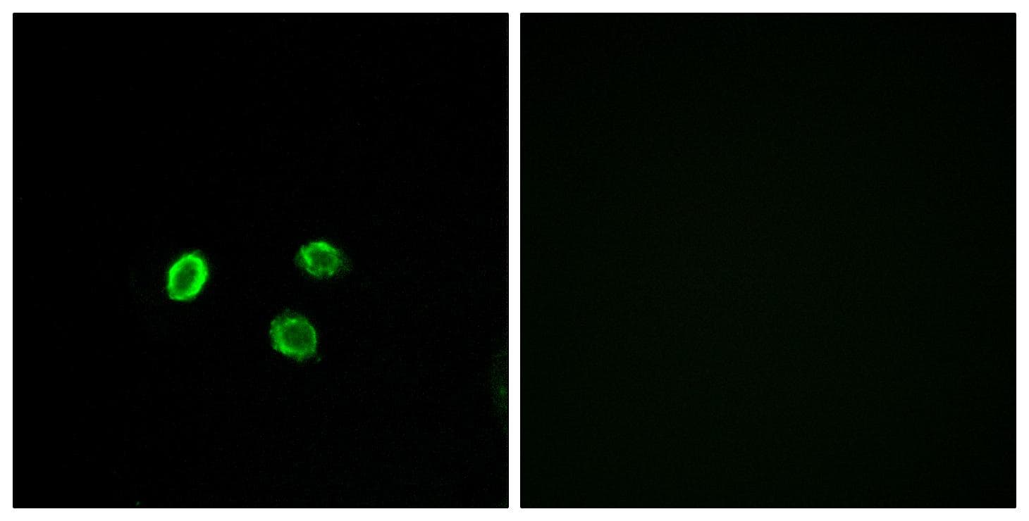 OR5M9 Antibody