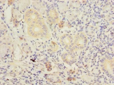 Polyclonal Rabbit anti-Human TMEM41A Antibody (IHC, WB)