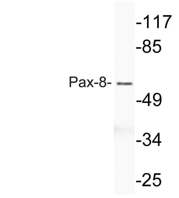 IHC-plus™ PAX8 Antibody (aa145-194)
