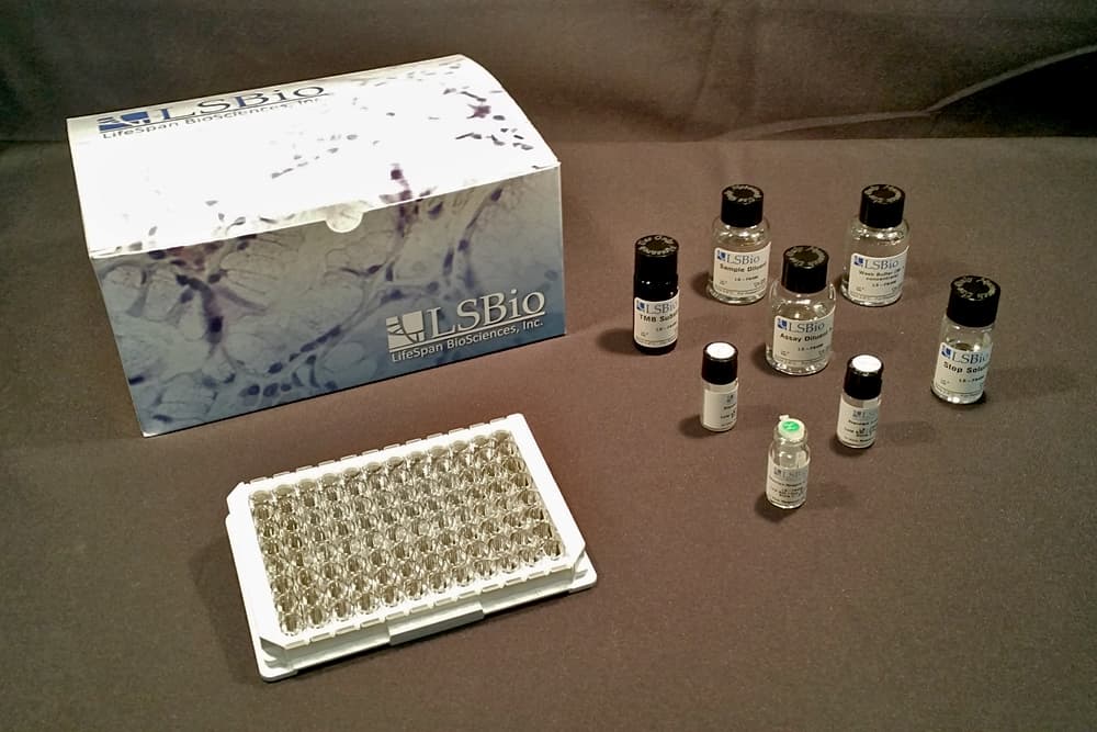 Mouse A2M / Alpha-2-Macroglobulin ELISA Kit (Competitive EIA)