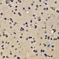 Polyclonal Rabbit anti-Human SKIV2L2 Antibody (IHC, WB)
