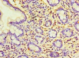 CCBL2 Antibody (aa1-454, Biotin)