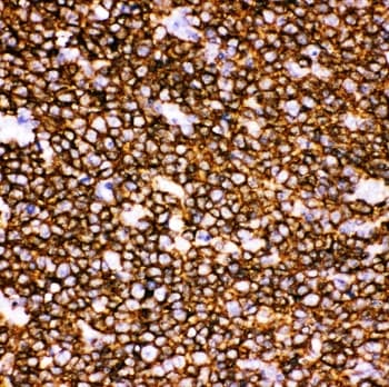 CD20 Antibody