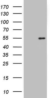 NKX2-1 / Thyroid-Specific TF Antibody (clone OTI10F3)