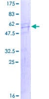 Human SPATA9 Protein (Recombinant GST)