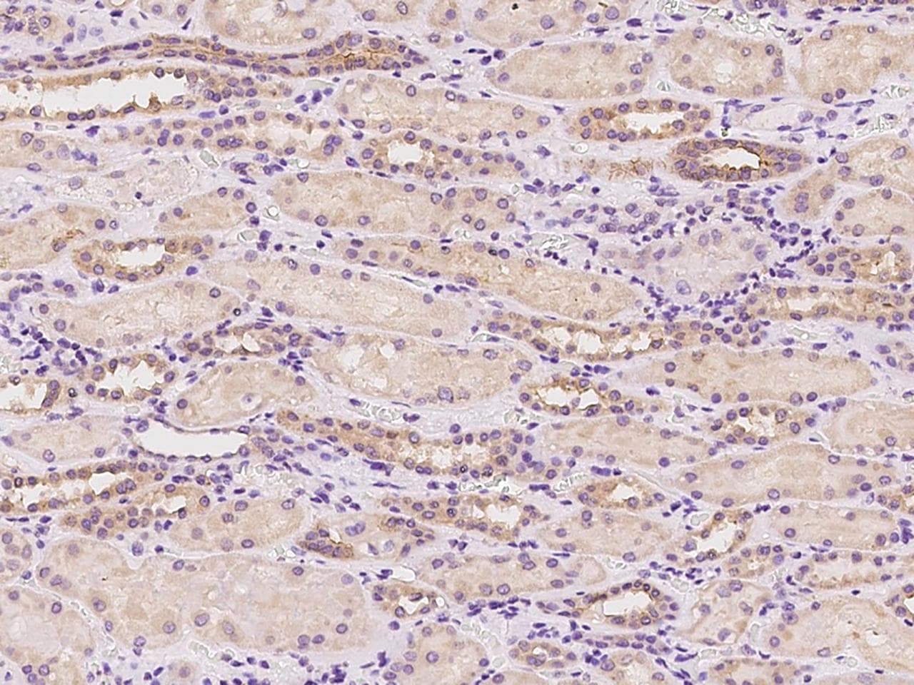MPP2 Antibody