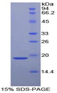 Human SERPINF2 / Alpha-2-Antiplasmin Protein (Recombinant His, N-Terminal)