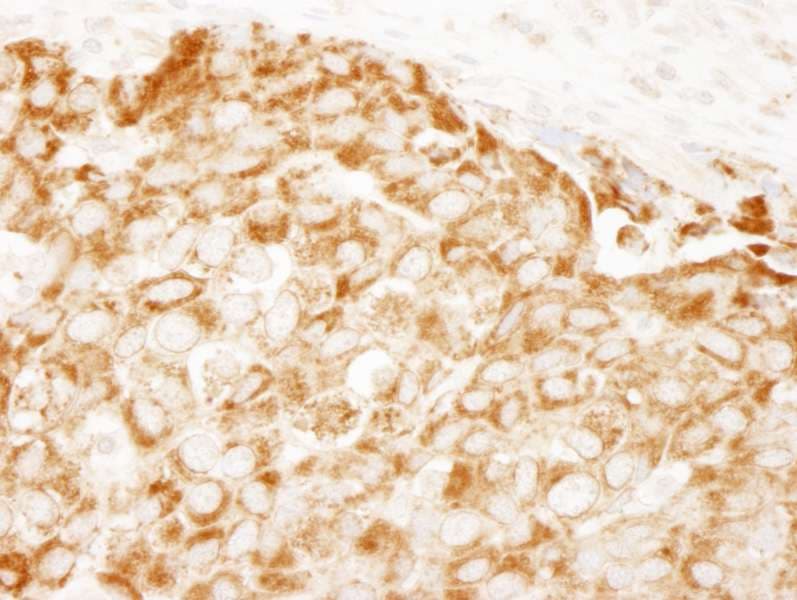 Polyclonal Rabbit anti-Human IRS1 Antibody (aa1192-1242, IHC, WB)